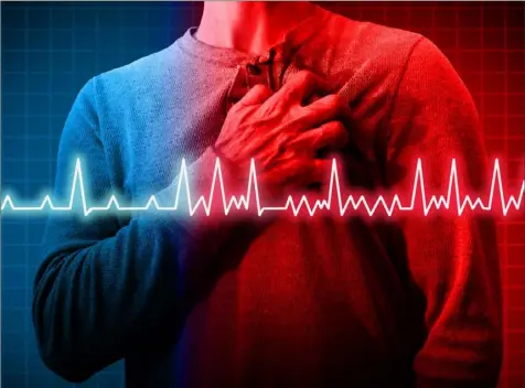  ?? Shuttersto­ck ?? The most common heart arrhythmia is atrial fibrillati­on or AFib. People who have had COVID-19 are at higher risk.