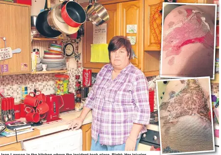  ??  ?? Jean Lawson in the kitchen where the incident took place. Right: Her injuries.