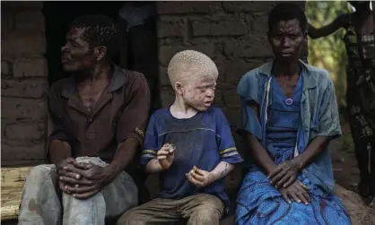  ?? Photograph: Gianluigi Guercia/AFP/Getty ?? An albino child with his parents in Nkole, Machinga district. People with albinism have faced violence in Malawi, with their body parts sometimes used in witchcraft rituals.