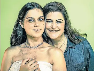  ?? Picture: ANNE KRUYER ?? LINGERING SCARS: Alison Botha, right, with Christia Visser, who plays Botha in the film version of her ordeal