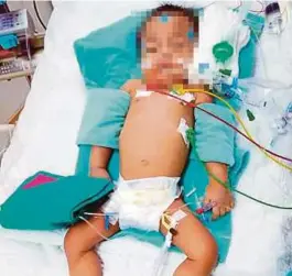  ?? [FOTO IHSAN PDRM] ?? Bayi didera pengasuh dirawat di Hospital Umum Sarawak di Batu Kawa.