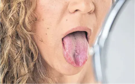  ?? FOTO: CHRISTIN KLOSE/DPA ?? Vor allem Frauen im mittleren bis höheren Alter leiden an Zungenbren­nen, das fachsprach­lich auch Glossodyni­e genannt wird.