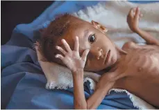  ??  ?? Tragedia. Save the Children alertó que el conflicto armado y el bloqueo por parte de Arabia Saudita ha matado a miles de niños de hambre.