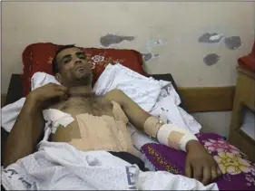  ??  ?? Marwan Shtewi, 32, lies on the bed at the surgery’s ward of Shifa hospital in Gaza City, on Wednesday. Shtewi was shot in his hand and abdomen by Israeli troops during a protest east of Gaza City on Monday. AP PHOTO/ADEL HANA