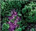  ?? Image courtesy of NIH ?? This color-enhanced image shows the virus that causes COVID-19, seen as purple.