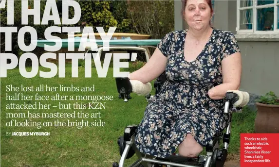  ??  ?? Thanks to aids such an electric wheelchair, Shaninlea Visser lives a fairly independen­t life.