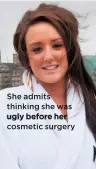  ??  ?? She admits thinking she was ugly before her cosmetic surgery