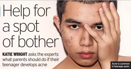  ?? ?? Acne is common in teenage years