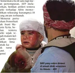  ??  ?? BAYI yang cedera dirawat di sebuah klinik sementara itu Ghouta. - AFP