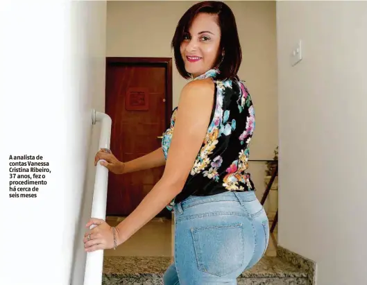  ?? Rubens Cavallari/Folhapress ?? A analista de contas Vanessa Cristina Ribeiro, 37 anos, fez o procedimen­to há cerca de seis meses