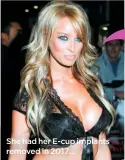  ??  ?? She had her E-cup implants removed in 2017… …and says she feels like she’s taken more seriously