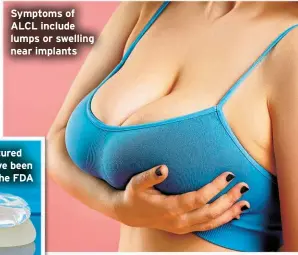  ?? ?? Symptoms of ALCL include lumps or swelling near implants