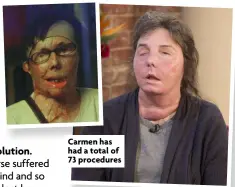  ?? ?? Carmen has had a total of 73 procedures