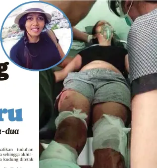  ??  ?? PUTU kudung kakinya selepas ditetak suami.
- Daily Mail