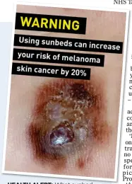  ?? ?? HEALTH ALERT: What sunbed warning labels could look like
