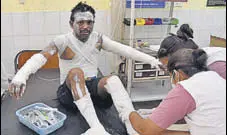  ?? GURPREET SINGH/HT ?? An injured being treated at the Ludhiana civil hospital on Thursday.