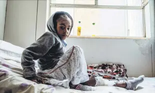  ??  ?? A 9-year-old girl rests on her bed at the Ayder Referral Hospital, Mekele, Ethiopia, Feb. 25, 2021.