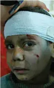  ?? Photo: AFP ?? Hossam Hawari, 8, is treated for a shrapnel wound yesterday.