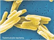  ??  ?? Tuberculos­is bacteria.