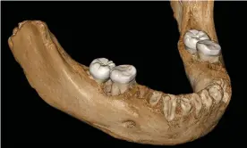  ??  ?? The Denisovan mandible likely represents the earliest hominin fossil on the Tibetan Plateau, researcher­s say. Photograph: Jean-Jacques Hublin/AFP/Getty Images