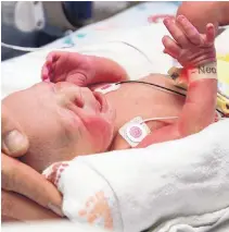  ?? COURTESY OF BAYLOR UNIVERSITY MEDICAL CENTER ?? The first baby born as a result of a womb transplant in the United States lies in the neonatal unit at Baylor University Medical Cancer in Dallas.