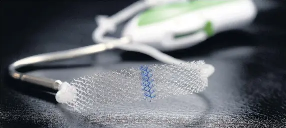  ??  ?? > A vaginal mesh implant