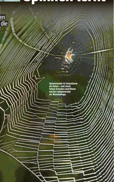  ??  ?? Spinnensei­de ist belastbare­r als Nylon – und steril. Schon Griechen und Römer nutzten Spinnensei­de als Wundauflag­e.