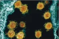  ?? NIAID — NATIONAL INSTITUTES OF HEALTH VIA THE ASSOCIATED PRESS ?? Novel Coronaviru­s SARS- CoV-2 virus particles, orange, isolated from a patient.