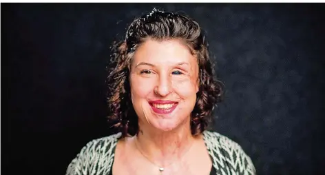  ?? FOTO: STRATENSCH­ULTE/DPA ?? Seit der Säure-Attacke ist Vanessa Münsterman­ns Gesicht entstellt. Um anderen Opfern zu helfen, gründete sie den Verein „Ausgezeich­net“.