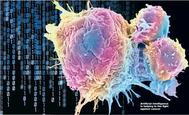  ??  ?? Artificial intelligen­ce is helping in the fight against cancer