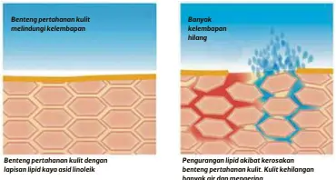  ?? FOTO ?? Benteng pertahanan kulit melindungi kelembapan Benteng pertahanan kulit dengan lapisan lipid kaya asid linoleik Banyak kelembapan hilang Penguranga­n lipid akibat kerosakan benteng pertahanan kulit. Kulit kehilangan banyak air dan mengering