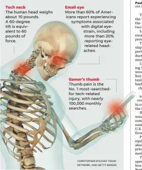  ?? CHRISTOPHE­R DYE/USA TODAY NETWORK, AND GETTY IMAGES ?? Tech neck The human head weighs about 10 pounds. A 60-degree tilt is equivalent to 60 pounds of force.
Email eye More than 60% of Americans report experienci­ng symptoms associated with digital eyestrain, including more than 20% reporting eyerelated...