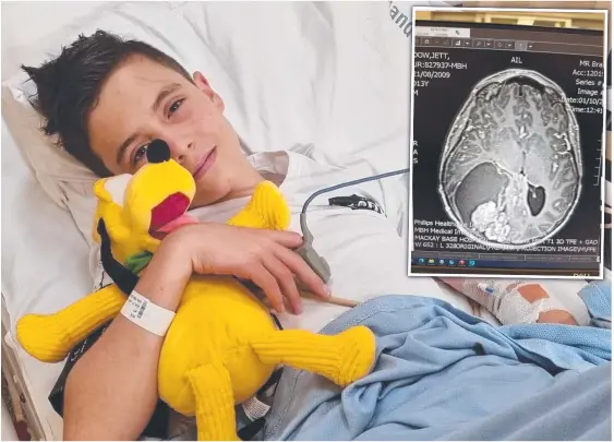  ?? ?? Doctors at Townsville University Hospital have removed a tumour and cyst the size of a tennis ball in 13-year-old Jett Dow's brain. Pictures: Supplied