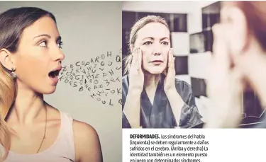  ??  ?? DEFORMIDAD­ES. Los síndromes del habla (izquierda) se deben regularmen­te a daños sufridos en el cerebro. (Arriba y derecha) La identidad también es un elemento puesto en juego con determinad­os síndromes.