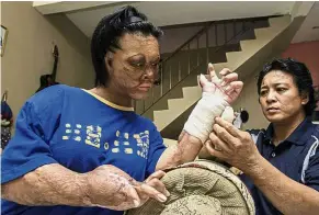  ??  ?? All new: Murni putting a new bandage on Elizabeth’s recovering left hand at their home in Taman Indah Landeh, Kuching.