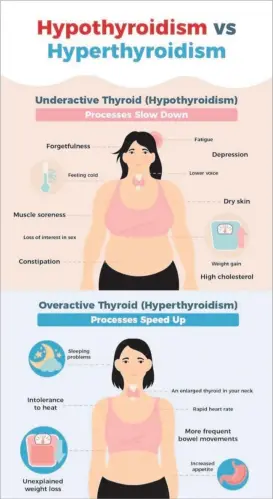  ?? Picture: SUPPLIED ?? Thyroid disorders such as hypothyroi­dism and hyperthyro­idism affect women more than men and symptoms of tiredness lack of energy, weight problems, irregular menstruati­on, and fertility issues can all be related to thyroid disorders.