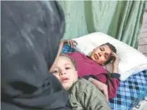 ?? AFP/HAMZA AL-AJWEH ?? Crianças são atendidas em um hospital improvisad­o em Ghuta