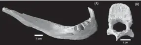  ?? Public Library of Science ?? A jawbone that belonged to a Hiroshima atomic bombing victim had absorbed 9.46 grays of radiation.