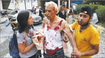  ?? Zuma Presstns ?? Wounded people sit on a street following an explosion in the Lebanese capital of Beirut on Tuesday.