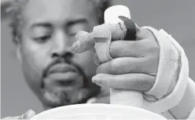  ?? KARL MERTON FERRON/BALTIMORE SUN ?? Mcneill grips a piece of wood with his injured hand, pressing indentatio­ns into a plastic bowl partially filled with putty to build up hand strength.