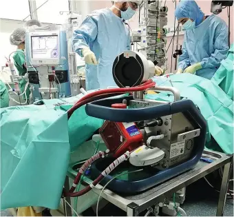  ??  ?? Développée­s à l’origine pour les opérations où le coeur doit être stoppé, les machines Ecmo sont au nombre de 514 dans le pays. Mais leur répartitio­n est très inégale.