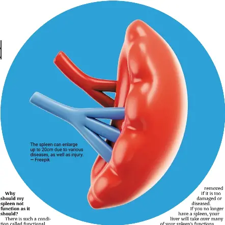 Do I really need my spleen? - PressReader