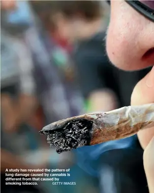  ?? GETTY IMAGES ?? A study has revealed the pattern of lung damage caused by cannabis is different from that caused by smoking tobacco.