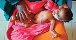  ??  ?? BAIDOA, Somalia: A severely malnourish­ed child in the hands of her mother waits to be processed into a UNICEF- funded health program catering to children displaced by drought, at the regional hospital in Baidoa town.