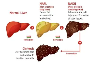 Liver in malay