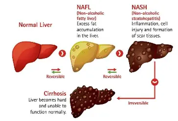 Take good care of your liver - PressReader