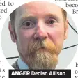  ??  ?? ANGER Declan Allison