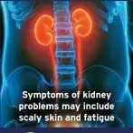  ?? ?? Symptoms of kidney problems may include scaly skin and fatigue