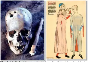  ??  ?? Like a hole in the head: Trepanning is thought to be one of the oldest surgical procedures, believed to cure epileptic seizures, headaches and mental disorders. Left is a 14th century drawing of the procedure and right is a scull with a series of bore...