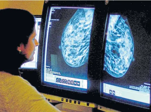  ?? ?? UNTREATED: Breast cancer screening services were put on hold from March 30 to August 3 in 2020.